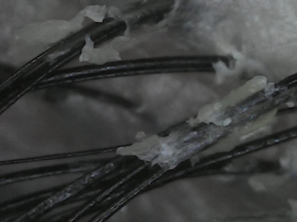 couro-cabeludo-ampliado Couro Cabeludo Ampliado