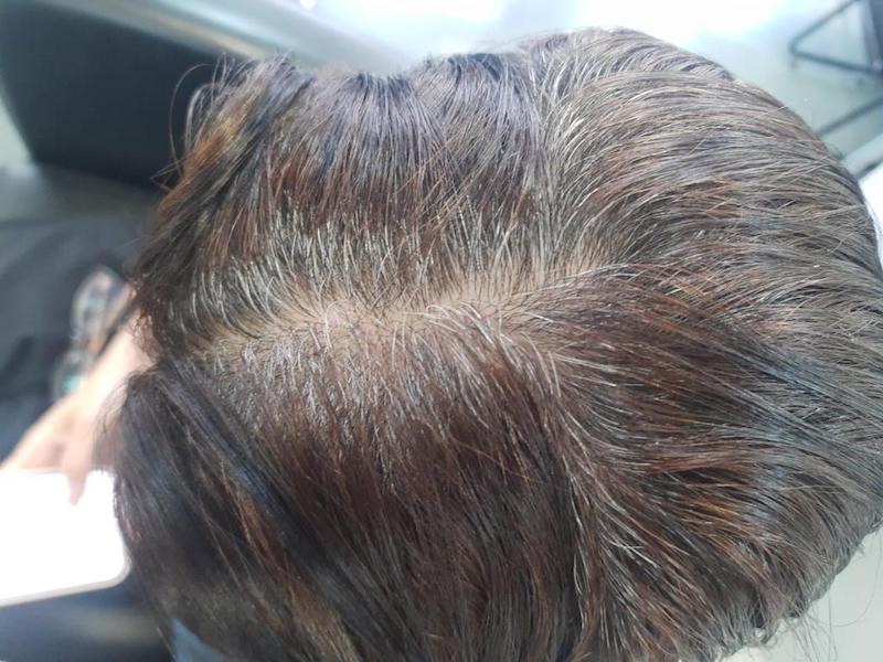 raiz-escura-antes Raiz Escura Antes