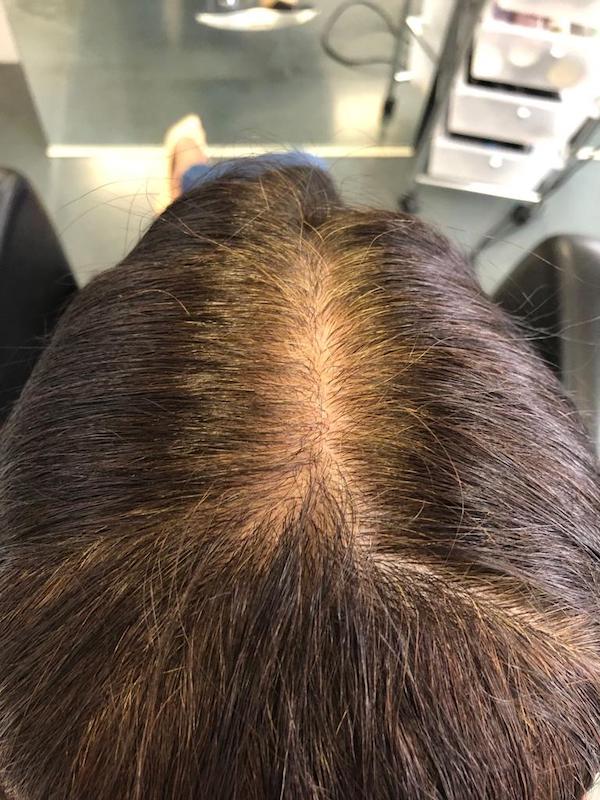 raiz-escura-depois Raiz Escura depois do Gloss Express